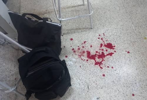 Alumno de secundaria en Iztapalapa, se dispara en un dedo en plena clases